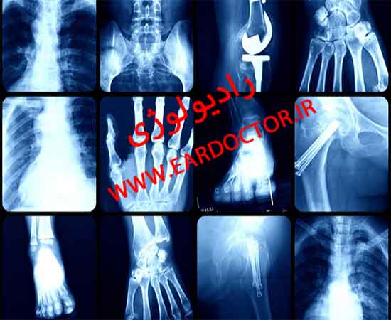 رادیولوژی در منزل ارزان در خوسف