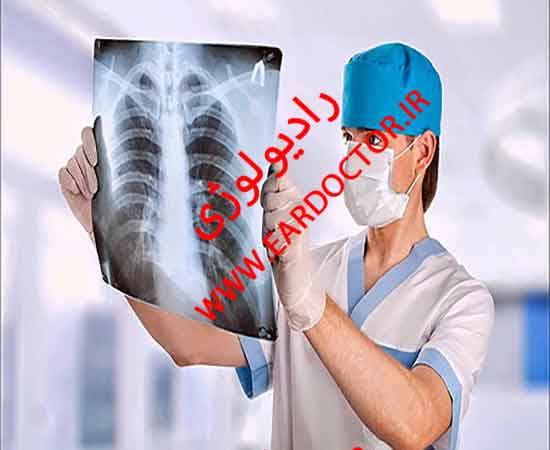 رادیولوژی در منزل فوری در خوسف