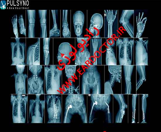عکس رادیولوژی