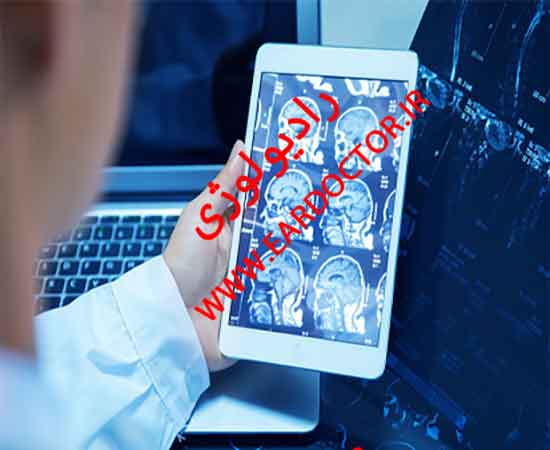 رادیولوژی در منزل آنلاین در خوسف
