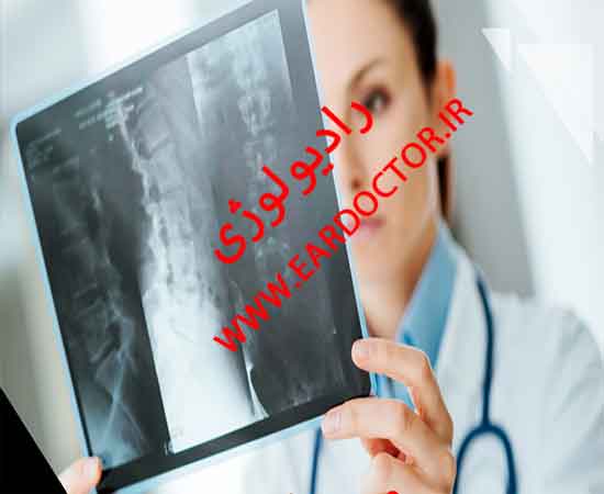 رادیولوژی در منزل در محل شما در خوسف